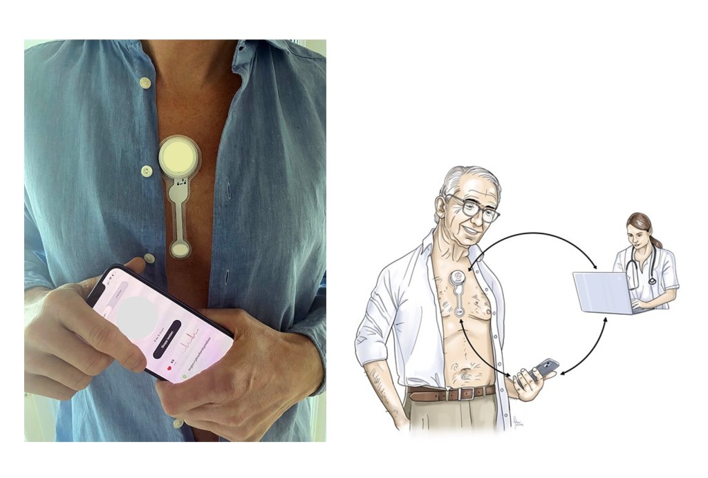 Kablosuz Holter cihazımız yara bandı gibi cilde yapışır. Yapay zeka teknolojisini kullanır.